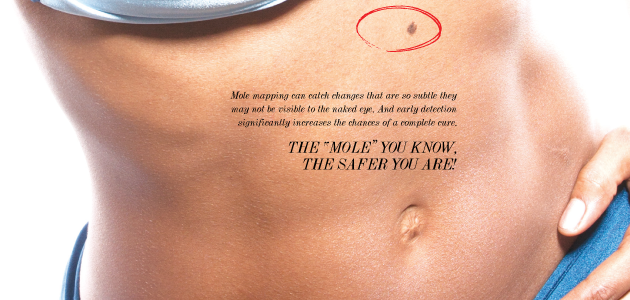 Skin Cancer Is No “S-Mole” Matter: Trust The Experts