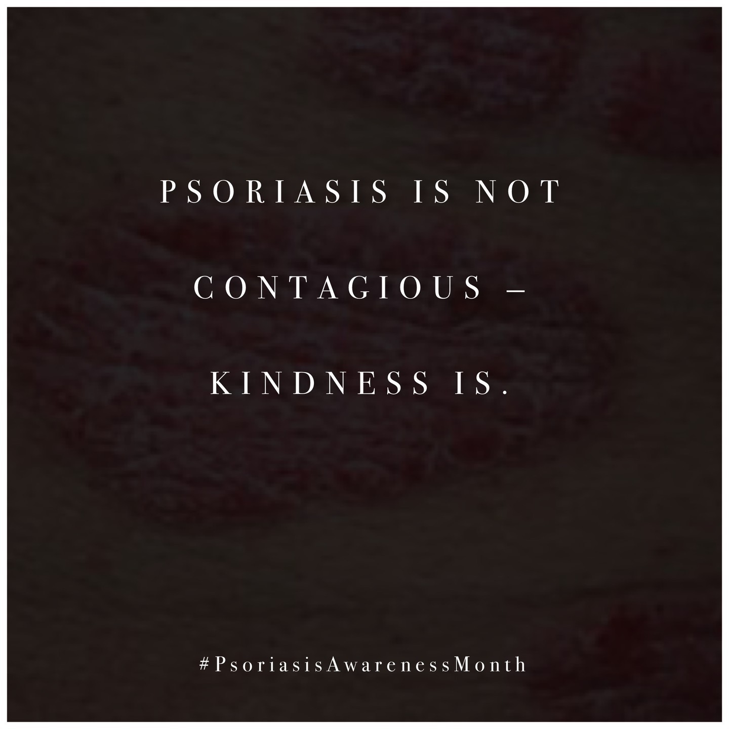 Psoriasis is not contagious. Kindness is. Learn more about the condition at VMVinSKIN.com to help support a loved one with psoriasis (including yourself! 💜💛)

#ThoughtfulThursday #skintellectual #psoriasis #psoriasisawareness #SavingTheWorldsSkin